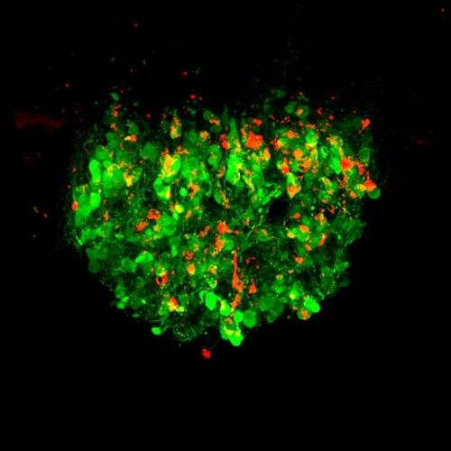 장의 신호로 흥분한 생쥐 뇌의 갈증 제어 뉴런(녹색·붉은색)  [UCSF 나이트 랩 제공]
