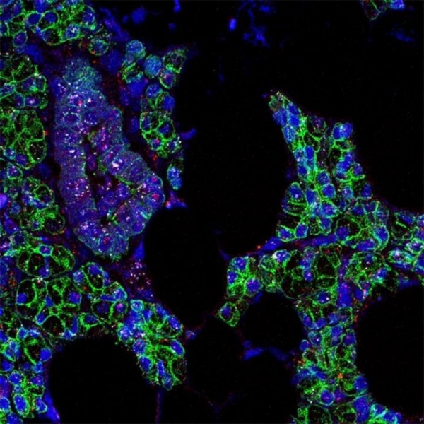 침샘 세포(녹색 윤곽)에서 발견된 신종 코로나 RNA(분홍색)와 ACE2 RNA(흰색) [미국 NIDCR 블레이크 워너 박사 랩 Paola Perez 제공 / 재판매 및 DB 금지]