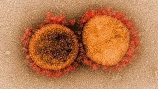 코로나19 바이러스 전자현미경 이미지[미국 국립 알레르기 감염병 연구소(NIAID) 제공. 재판매 및 DB 금지]