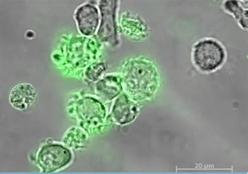 NK세포의 암세포 검문암세포(녹색)의 존재를 면역계에 알리기 위해 외막 조각을 뜯어내는 NK(자연살해)세포.[캐나다 오타와대 연구팀의 2022년 4월 13일 '사이언스 어드밴시스' 논문 캡처. 재판매 및 DB 금지]